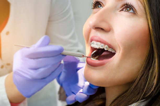 What is Root Canal? Does it Painful?